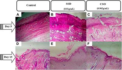 In vivo and in silico studies of the effects of oil extracted from Cannabis sativa L. seeds on healing of burned skin wounds in rats